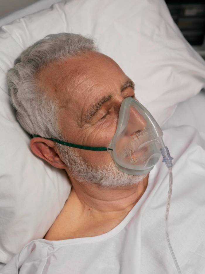 Obstructive Sleep Apnea (OSA)